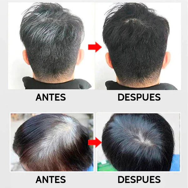 SHAMPOO PINTA CANAS - ENVIO GRATIS + REGALO